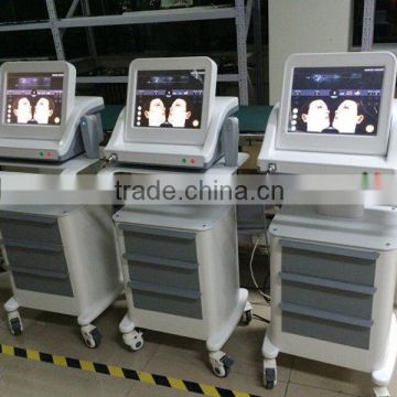 4MHZ 2015 Best High Intensity High Frequency Skin Machine Focused Ultrasound HIFU Machine 300W