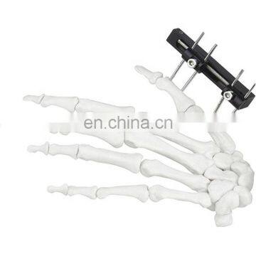 CE & ISO Marked Mini Fragment External Fixator (Finger and Palm) Surgical Instrument photo-7