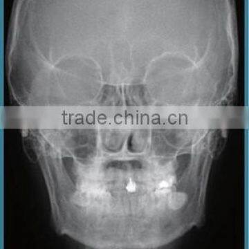 Dental X Ray Machine photo-4