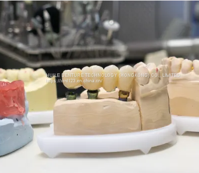 Zirconia Crown And Bridge China Dental Laboratory