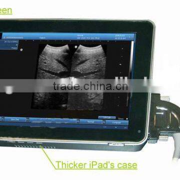 ce approved Ultrasound machine with best price