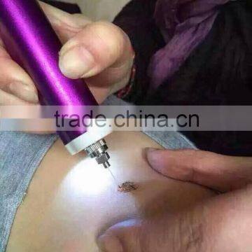 High Frequency Spot Removal Pen Speckle Removal photo-5