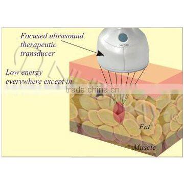 Top Selling Hifu Cavitation High Intensity Focused Ultrasound Hifu for Weight Loss photo-5