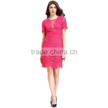 Fashion Lace Patchwork Short Frock Lady Image Skater Dress photo-3