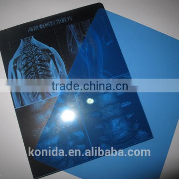 agfa x-ray film 14x17 blue medical film 8x10in made in Chinafilm for hospital agfa x-ray film