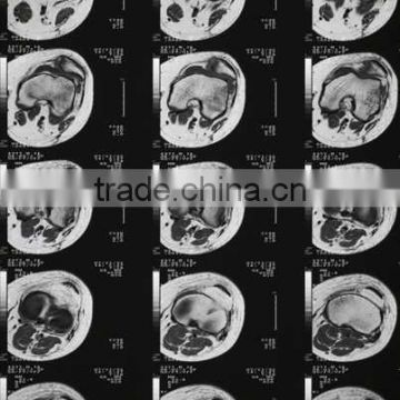 medical x-ray film agfa, fuji medical x-ray film for eeg medical equipment