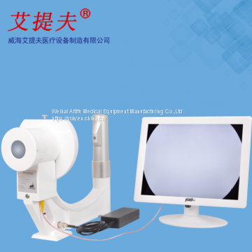 Portable Diagnostic X-Ray Machine