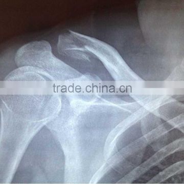 china x-ray dry film,hot sex images for ct scan