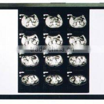 Konida x-ray film scrap,printed with fuji thermal printers