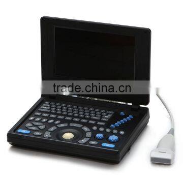China Factory Low Price Mini Laptop Portable Ultrasound Scanner Medical Price for Obstetrics and Gynecology Examine From China photo-2