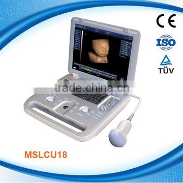 MSLCU18K 3D4D USG Full digital Plus 4D Laptop Ultrasound 4D ultrasound machine