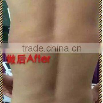 Double Chin Removal Nasolabial Folds Removal Cavitation Slimming Machine Hifu 7mm &13mm Fat Loss Machine Eye Lines Removal Increasing Muscle Tone photo-5