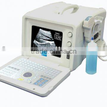 Ultrasound scanner