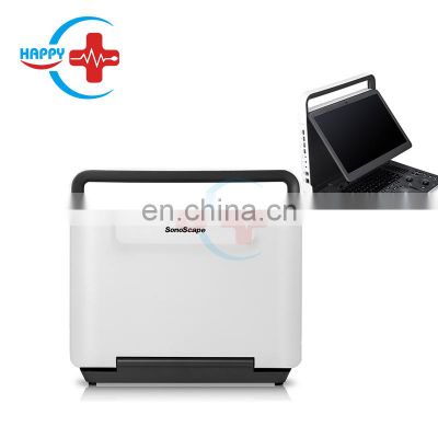 Best Portable ultrasound device machine price Sonoscape e1v