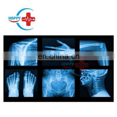 HC-D003 Newest Medical X-ray Diagnostic Equipments Portable Digital X-ray Machine For Veterinary photo-3