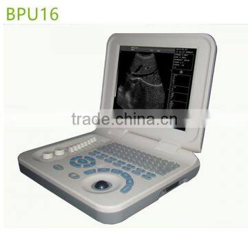 Manufacture Supplies low price Ultrasound Machine/laptop Ultrasound Scanner- BPU16