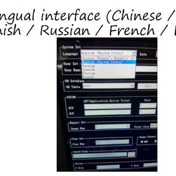 China Trolley 4D Color Doppler Ultrasound (YJ-U10T) photo-4