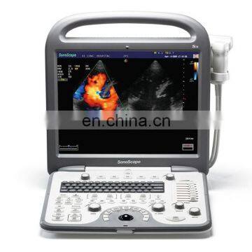 S8 Echocardiography Machine 2D 3D 4D  Echo portable doppler ultrasound scanner/ultrasound machine