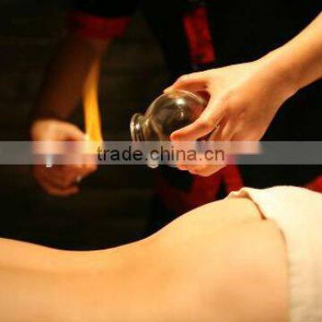 Raditional Fire Cupping, Glass Cupping photo-2