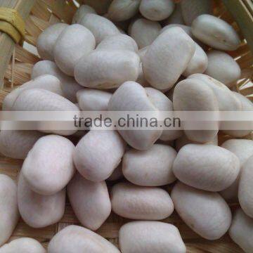 Medium white kidney bean 2011 crop, Heilongjiang origin, Hps)