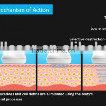 8MHz 2016 Body Shape Fastest Weight Loss Chest Shaping Slimming Liposonix HIFU Portable Ultrashape Cavitation Machine High Frequency Beauty Machine photo-5