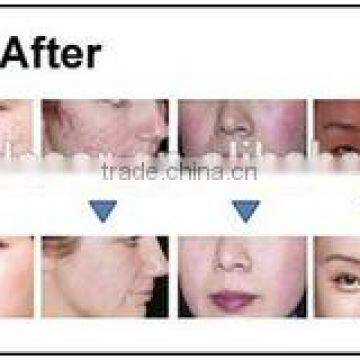 Painless Best Selling 3 in 1 Beauty Instrument 3 in 1 Machine Best Shr Ipl Machine Hair Removal photo-4