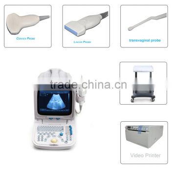 CE approved PC Portable Ultrasound Scanner with 3.5Mhz multi-frequency convex probe RUS-9000A