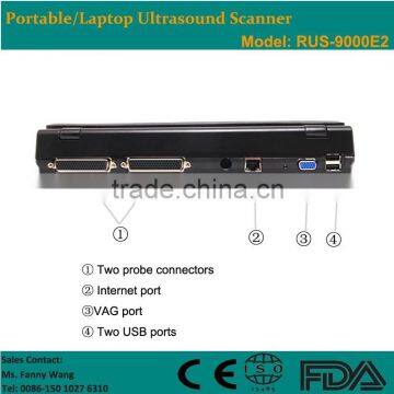 CE Approved Laptop Portable Ultrasound Scanner With 3.5Mhz Multi-frequency Convex Probe RUS-9000E2 photo-3