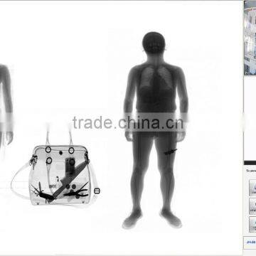 Low Dosage X-ray Machine for Security and Medical Inspection photo-4