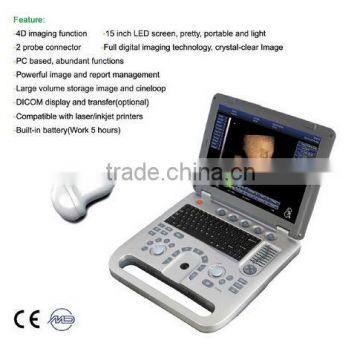 4D portable ultrasound SS-10Plus