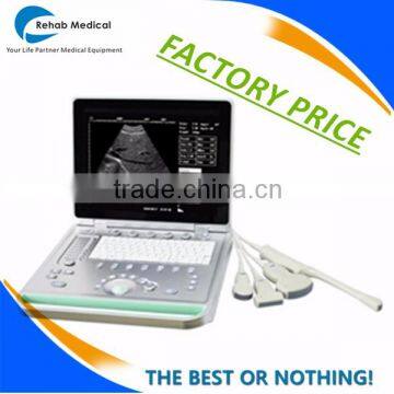 BPU09 Pregnancy Test Inspect Laptop Ultrasound Machine for sale