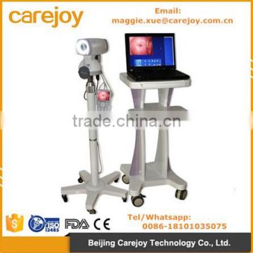 Video Electronic Colposcope RCS-500 SONY Camera CCD 800,000 pixels or 1,000,000 pixels