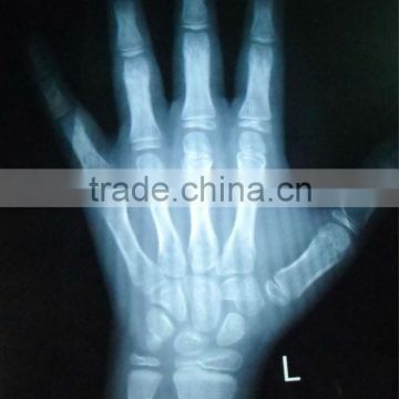 medical thermal x-ray film 14x17 with CE license and ISO 13485