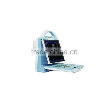 Cardiac Portable Ultrasound 3D 4D Ultrasound Scanner Color Doppler Ultrasound Machine Price photo-2