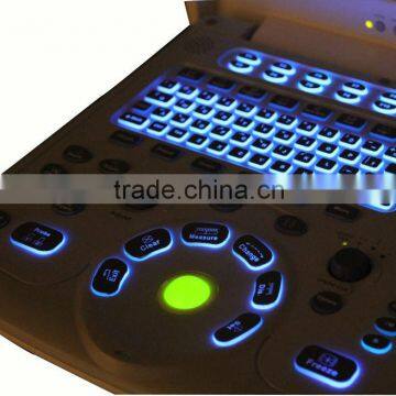 MSLCU01 Best Seller Portable Color Doppler Ultrasound in China