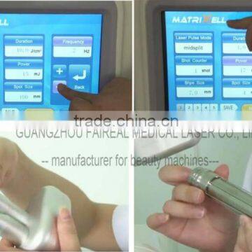 Chest Hair Removal Co2 Fractional Laser Vaginal Tightening Laser Vascular Lesions Removal 40w Beauty Equipment Better Than Vaginal Tightening Stick FDA Approved photo-2