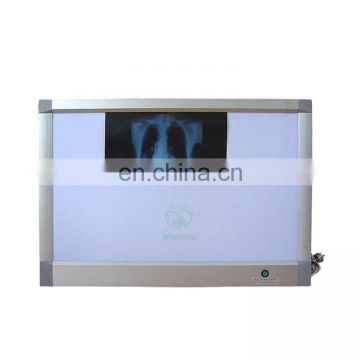 MA-1149 x-ray viewing box double film viewer