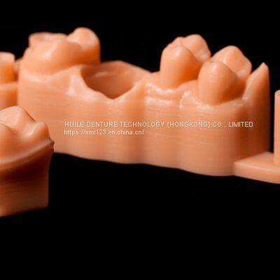 Digital-Crowns-Bridges Chinese Dental Lab Denture photo-3