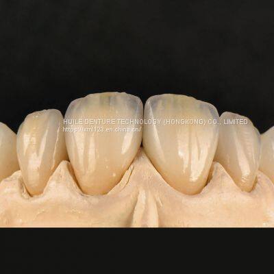 Digital-Crowns-Bridges Dental Laboratory in China photo-5