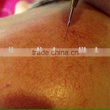 high technology CDT Carboxy therapy Stretch marks Removal beauty products with best price