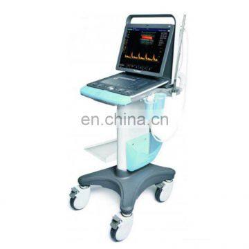 MY-A045 portable laptop color doppler ultrasound scanning machine,diagnostic ultrasound equipment