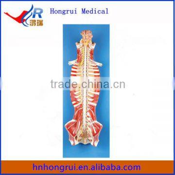 spinal cord and spinal nerves in the Spinal Canal