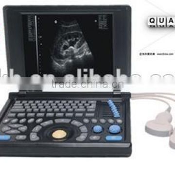 100% Guarantee CE Approved Laptop Portable Ultrasound Scanner 4 Optional probes Ultrasound system 18 month warranty