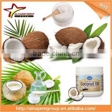 Hot Hot Coconut Oil Refinery Machine Coconut Oil Refinery Machine Coconut Oil Making Machine photo-5