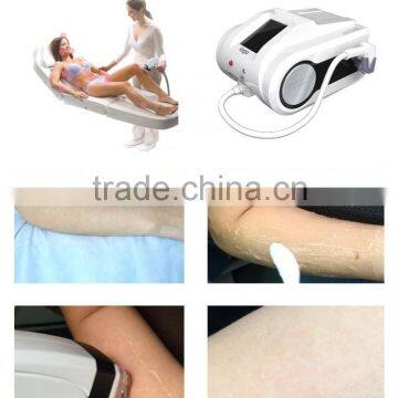 Permanent Factory Price 810nm Diode Laser For Hair Removal 810 Diode Laser Arm / Chest Hair Removal photo-5