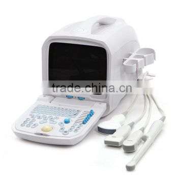 Highly recommend portable Ultrasound Scanner optional Convex , Micro-convex,Transvaginal,Linear,Rectal probe RUS-9000A supplier