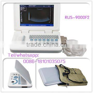 CE laptop Ultrasound machine with multi frequency probe ultrasonic diagnostic system RUS-9000F2