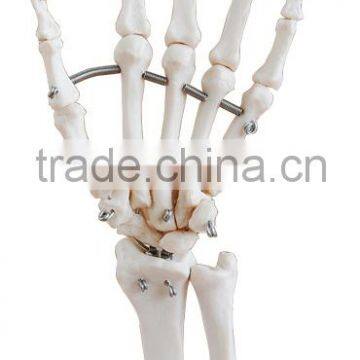 Life-Size Elastic Hand Joint Model