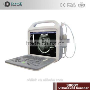 Full digital Portable Ultrasound scanner 3000T