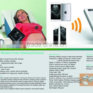 portable and best quality probe wireless ultrasound scanner